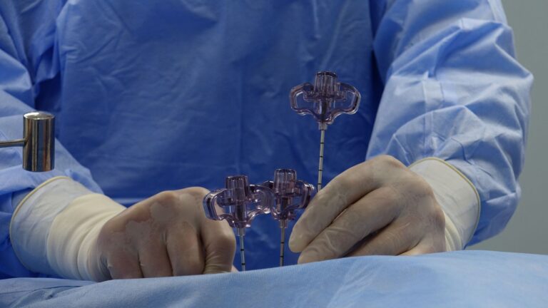Close-up of a surgeon's hands wearing gloves and operating tools in a sterile environment.